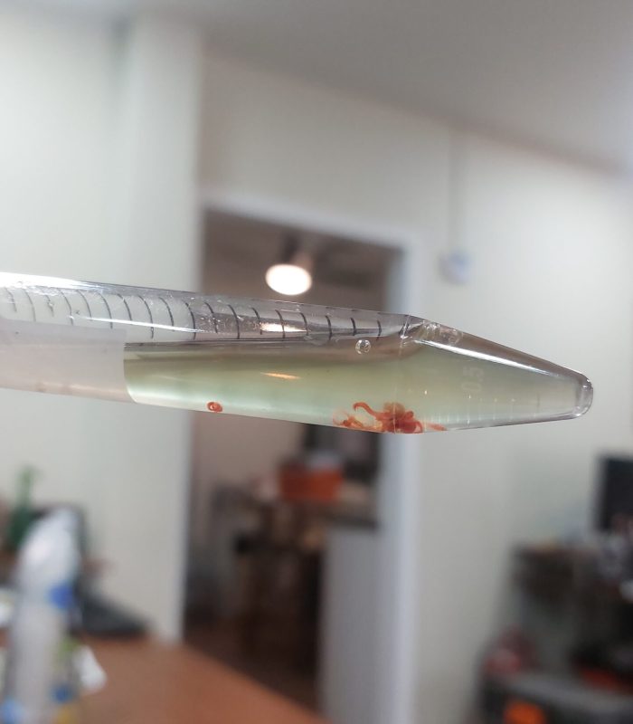 20250605 - Encontrado en los drenes por Grecia -